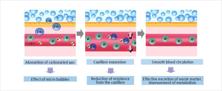 Basic concept of carbureted spring